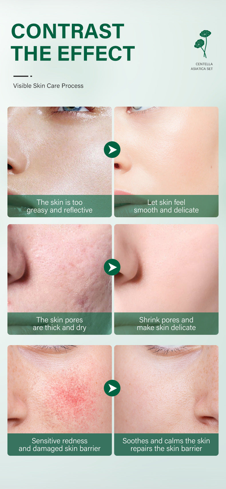 Private Label Skin Repair Centella Skin Care Kit