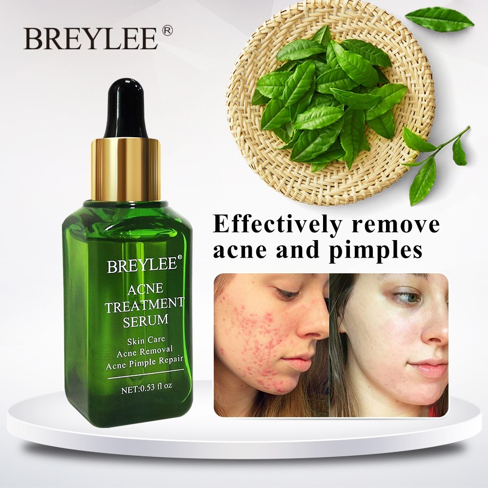 BREYLEE Acne Treatment Serum Face Facial
