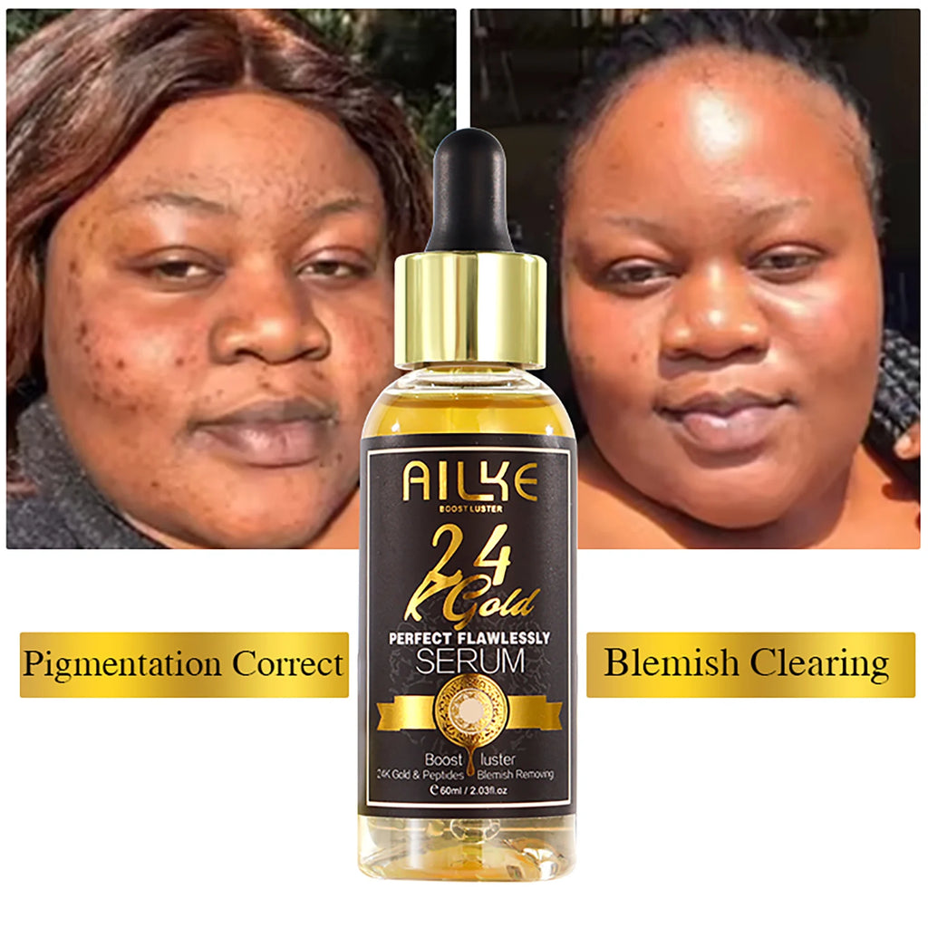 AILKE 24K Gold Flawlessly Serum, Whitening, Deep Clean Skin, Even Skin Tone, Reduce Black Spots, With Peptide, For Face & Body