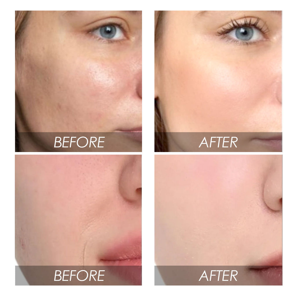 EELHOE Avocado Watermelon Facial Essence